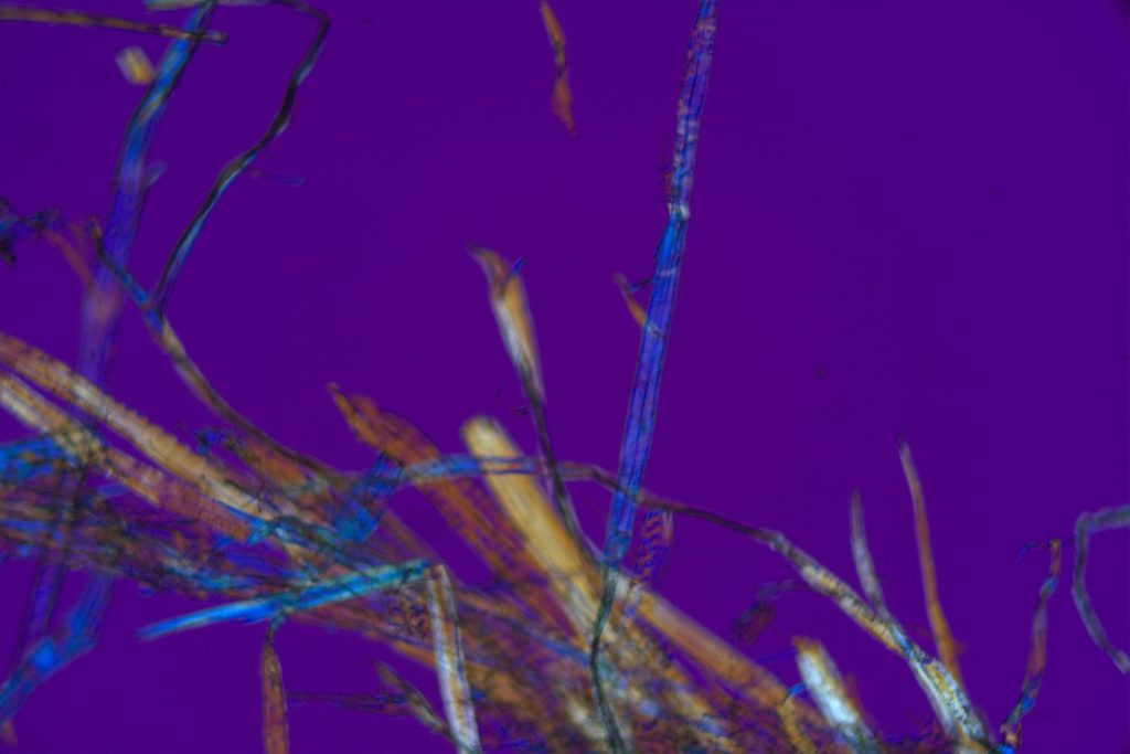 Asbestos Testing Micrograph