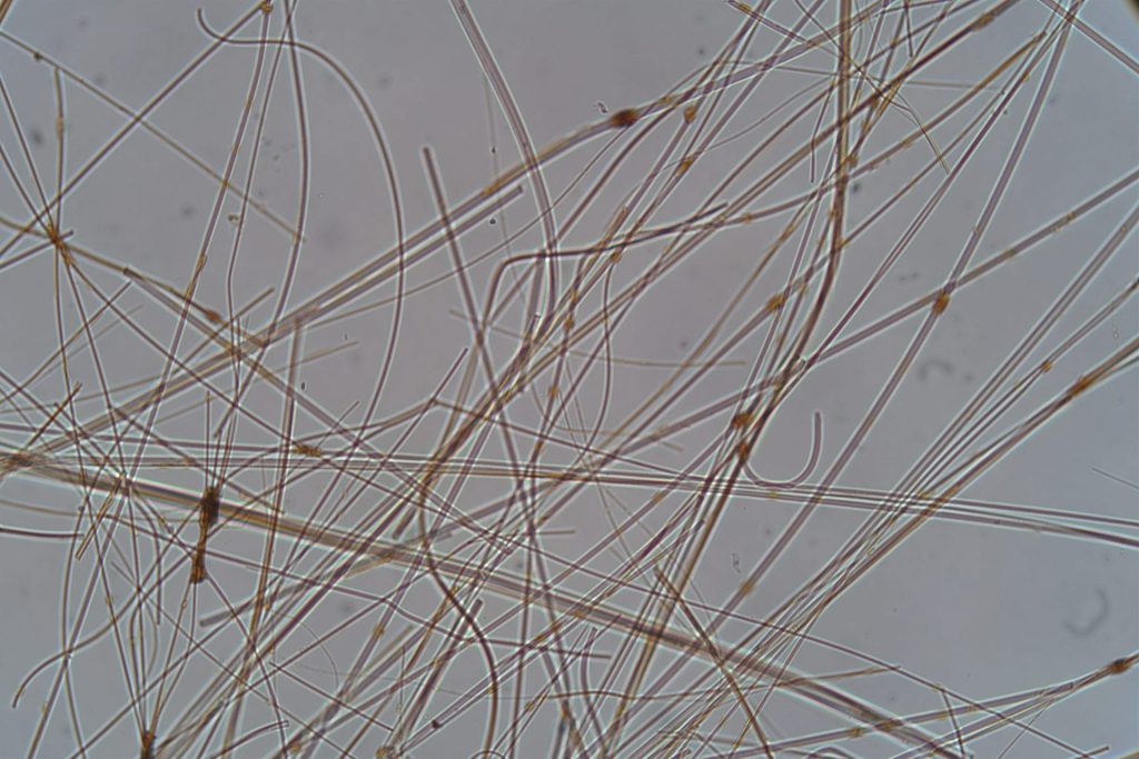 Asbestos Testing Micrograph