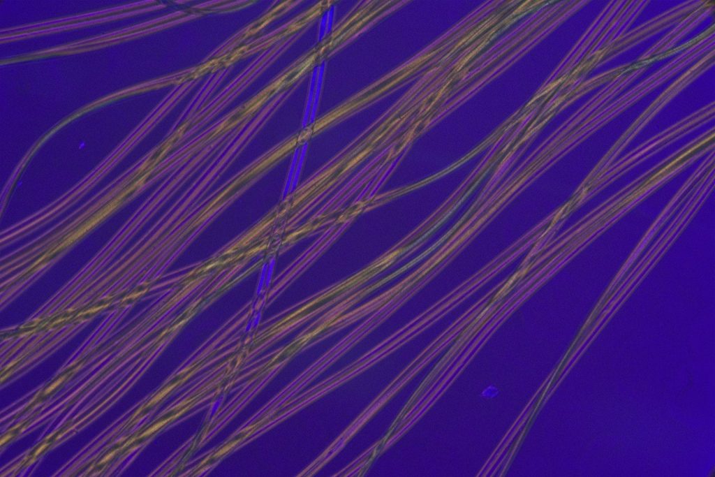 Asbestos Testing Micrograph