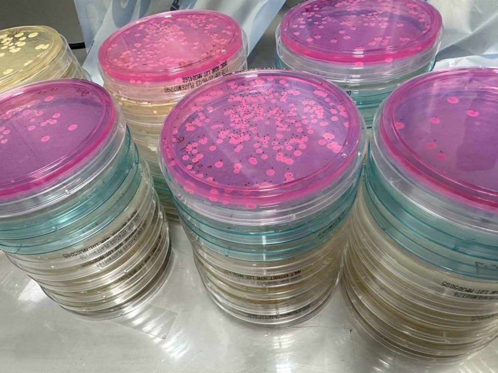 Mould, yeast bacteria air testing-operating theatre