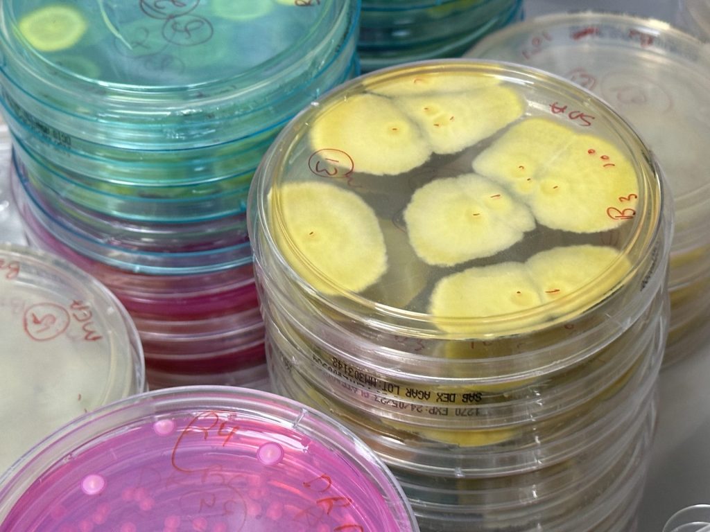 Mould testing-viable mould