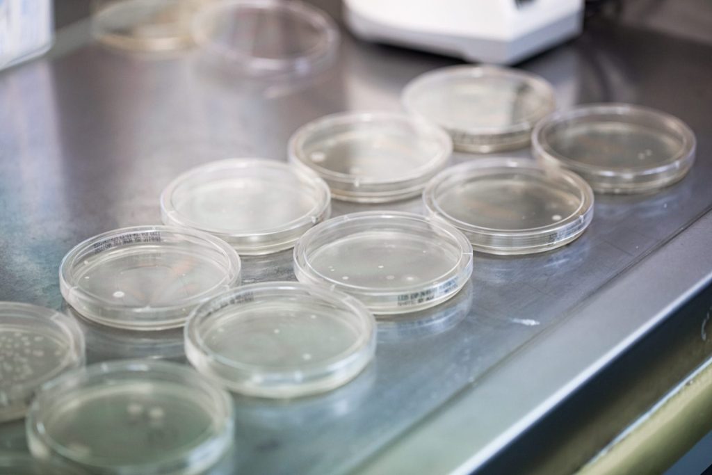 Air Testing for mould, yeast and bacteria