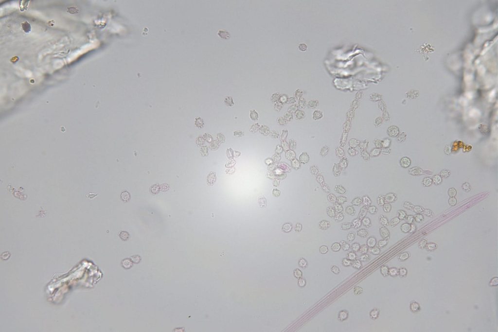 Particle Identification-Mould